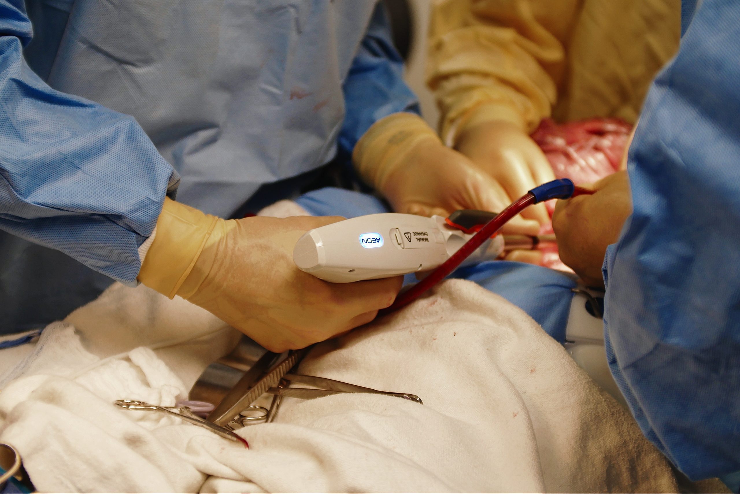 Surgeon using the AEON Powered Surgical Stapler 2.0 in the OR, side down.